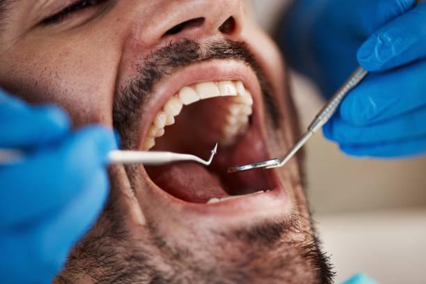 Best Cosmetic Emergency Dentistry in California, MD