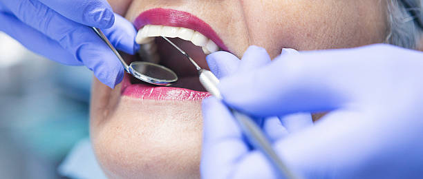 Best Emergency Denture Repair in California, MD